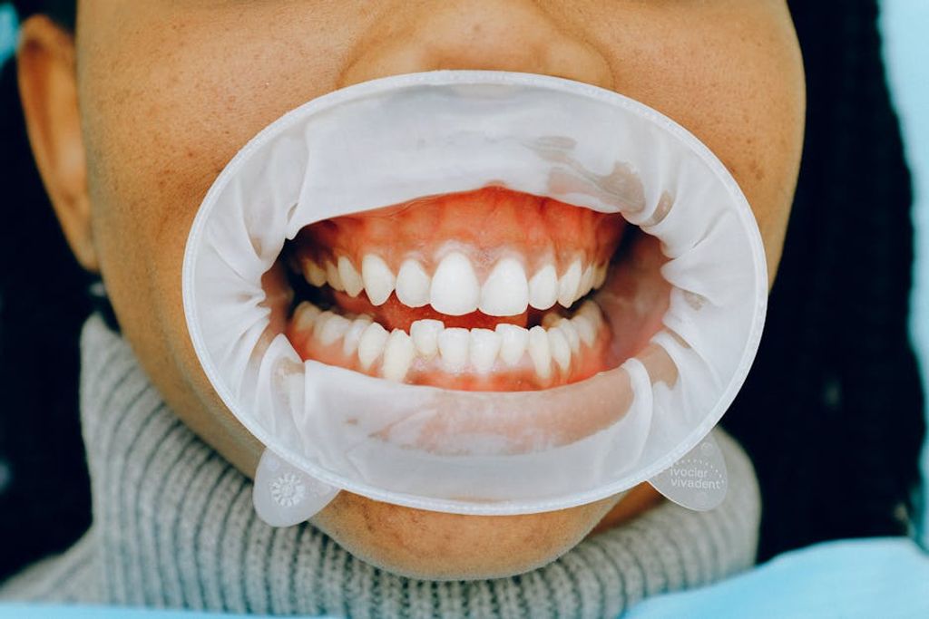 dental implants smile